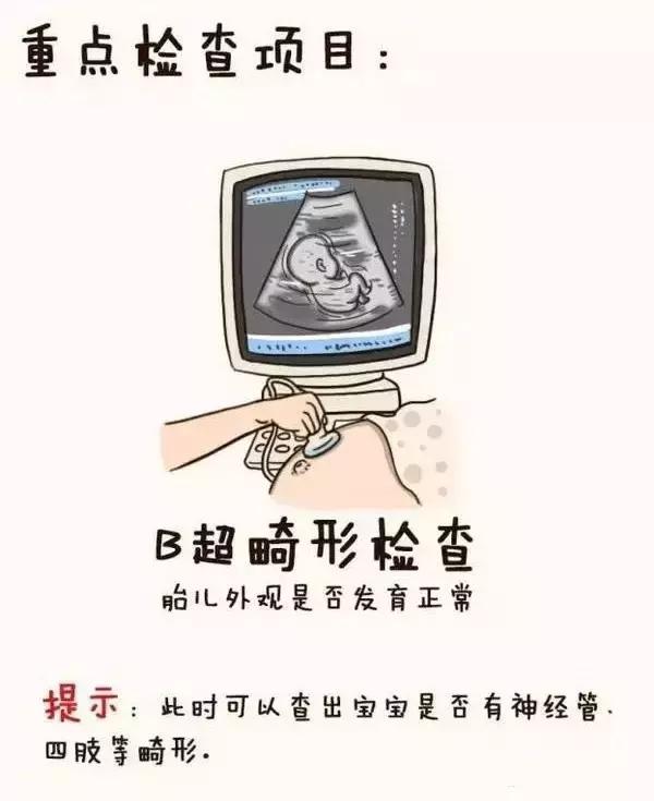 孕妇产检全流程手绘图,产科医生画图