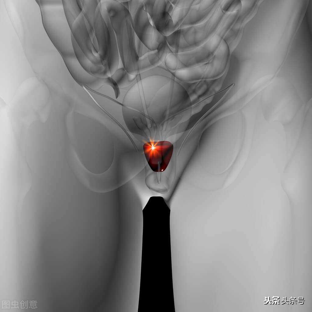 前列腺炎怎么治疗才会断根,前列腺炎怎么治疗尿频