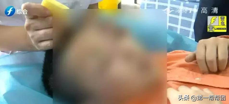 孩子眼睛胀痛，到私立治疗机构做眼部电刺激护理！没想到，一个星期后……