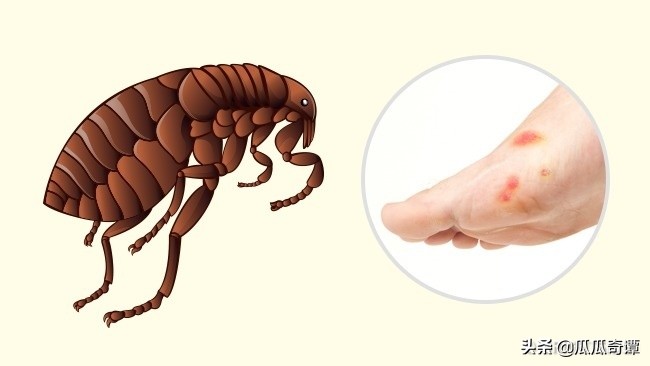 夏季蚊虫叮咬教你一招轻松解决,各种昆虫叮咬清晰图片对照表