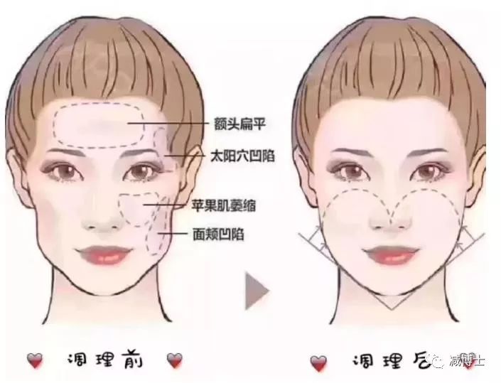 男生脸太大怎样瘦脸,脸胖的男生怎么瘦脸