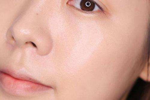 皮肤脱皮干红发热，长痘出油，紧绷潮红你知道如何解决吗