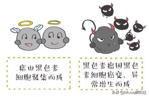 眼下有痣胸上也必定有痣吗,左胸有痣在上右胸有痣在下