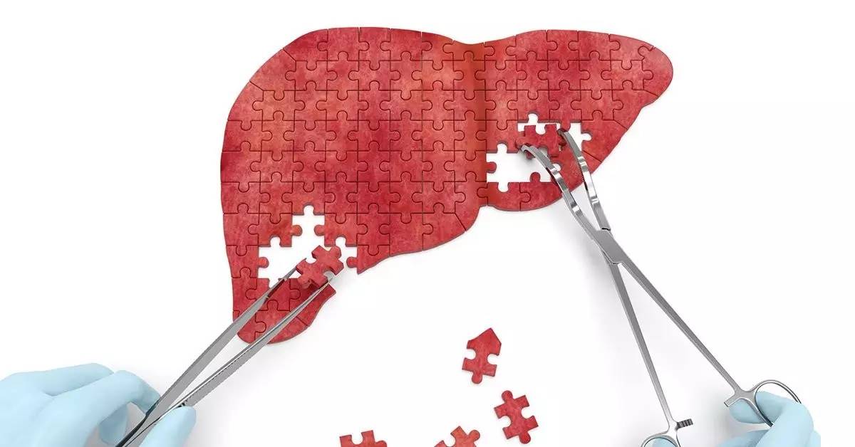 肝衰竭有治愈的希望吗,重度肝衰竭是什么原因造成的