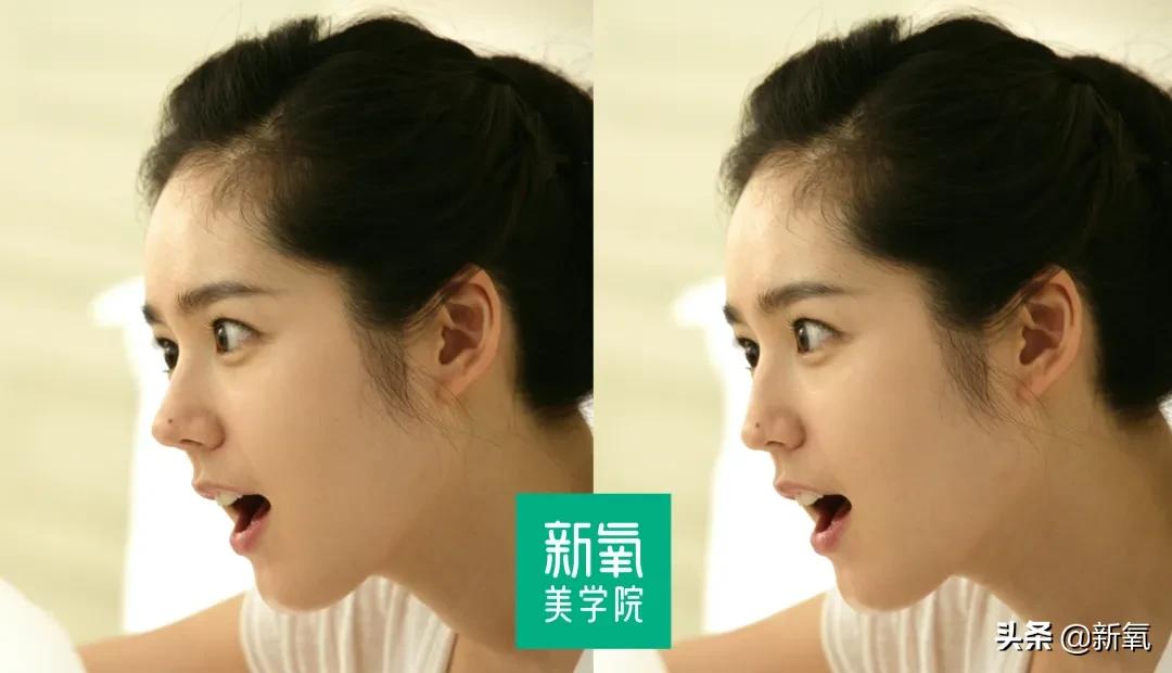 短翘鼻漂亮女星,小翘鼻适合方形脸