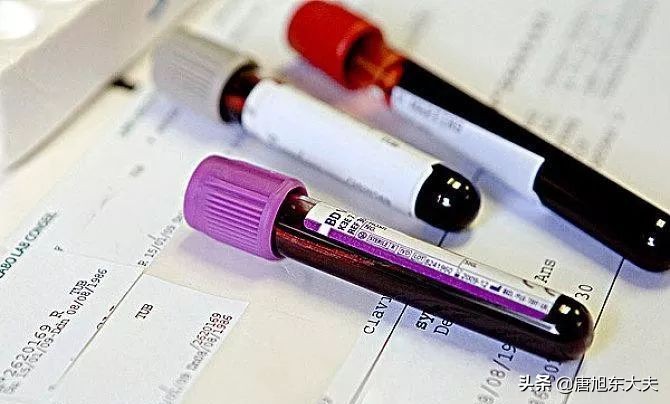 慢粒白血病什么症状查什么,慢粒白血病加速诊断