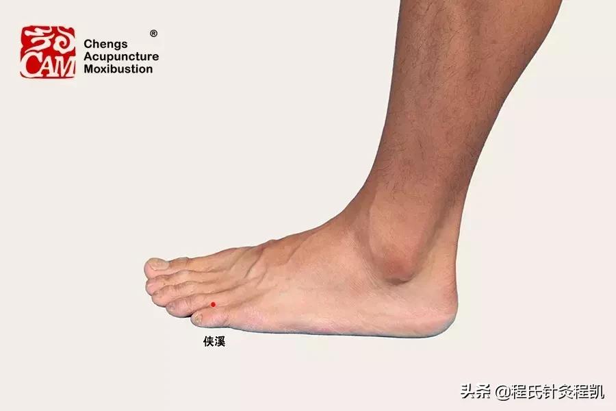 乳腺增生乳房胀痛怎么办,乳腺增生艾灸怎么治