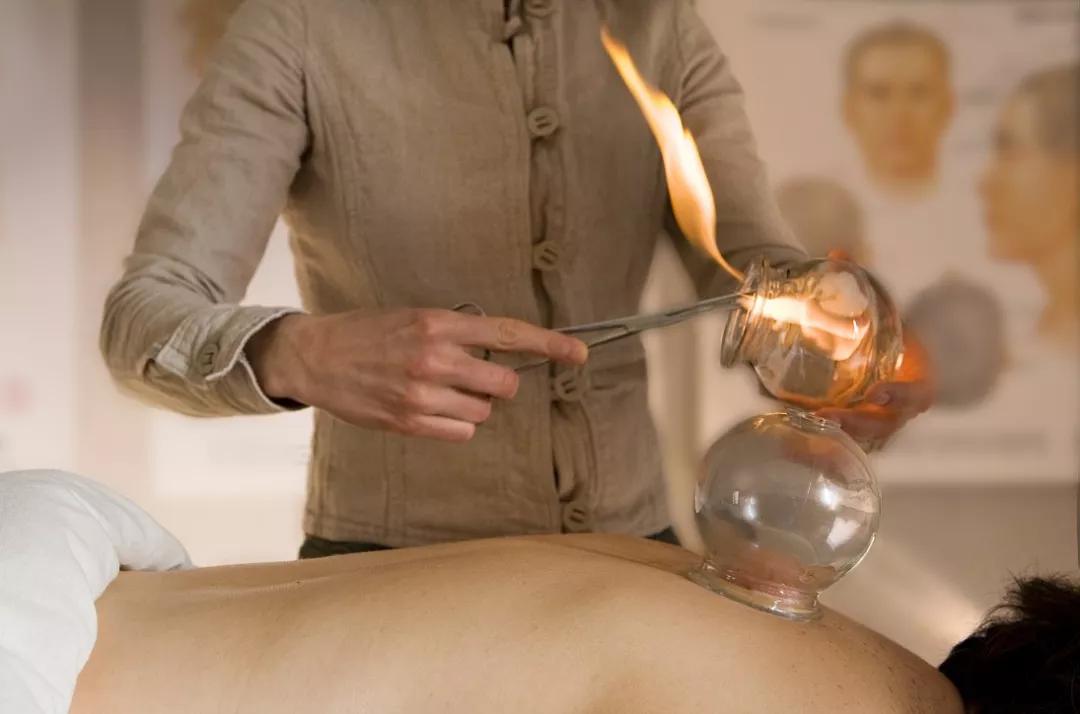 拔火罐烧伤的明星,明星拔火罐烧伤