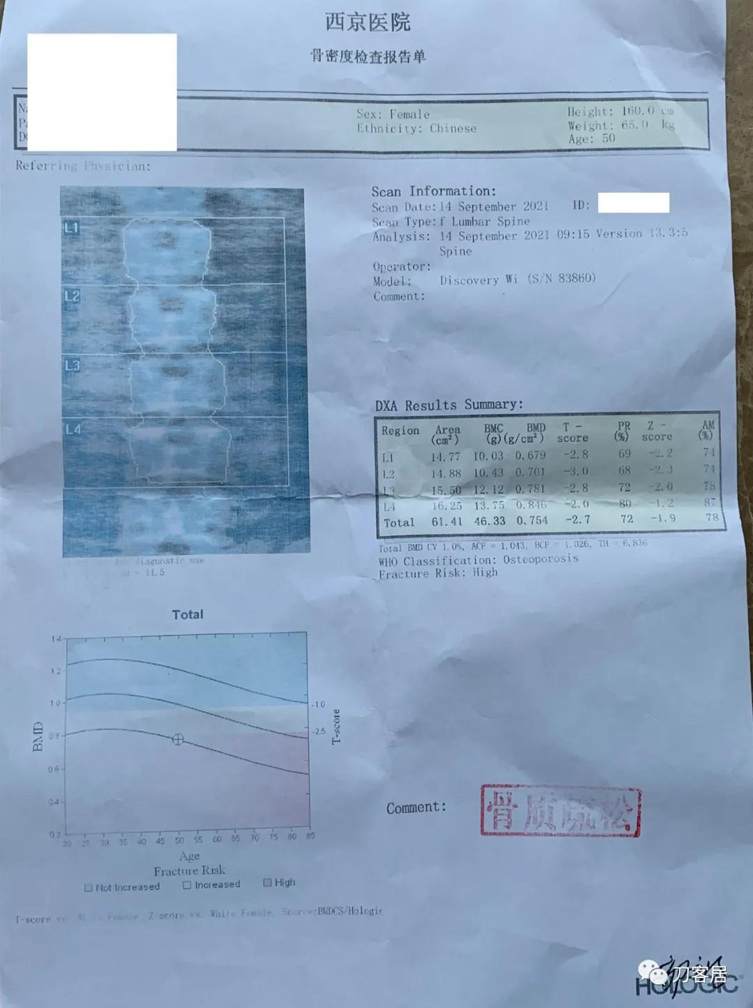 左下肢疼痛病历,门诊腹痛病历