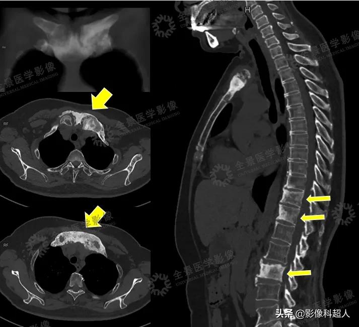 一些极其罕见的疾病,有哪些极其罕见的病
