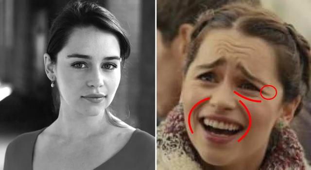 硬刚女皇龙妈也扛不住法令纹，2条沟壑让人心疼，贴一贴就消了