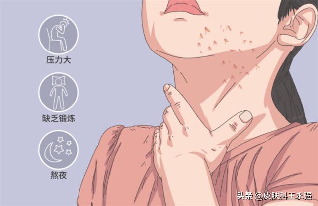 脖子上的小肉粒丝状疣怎么传染,脖子上长的小疙瘩是病毒性扁平疣