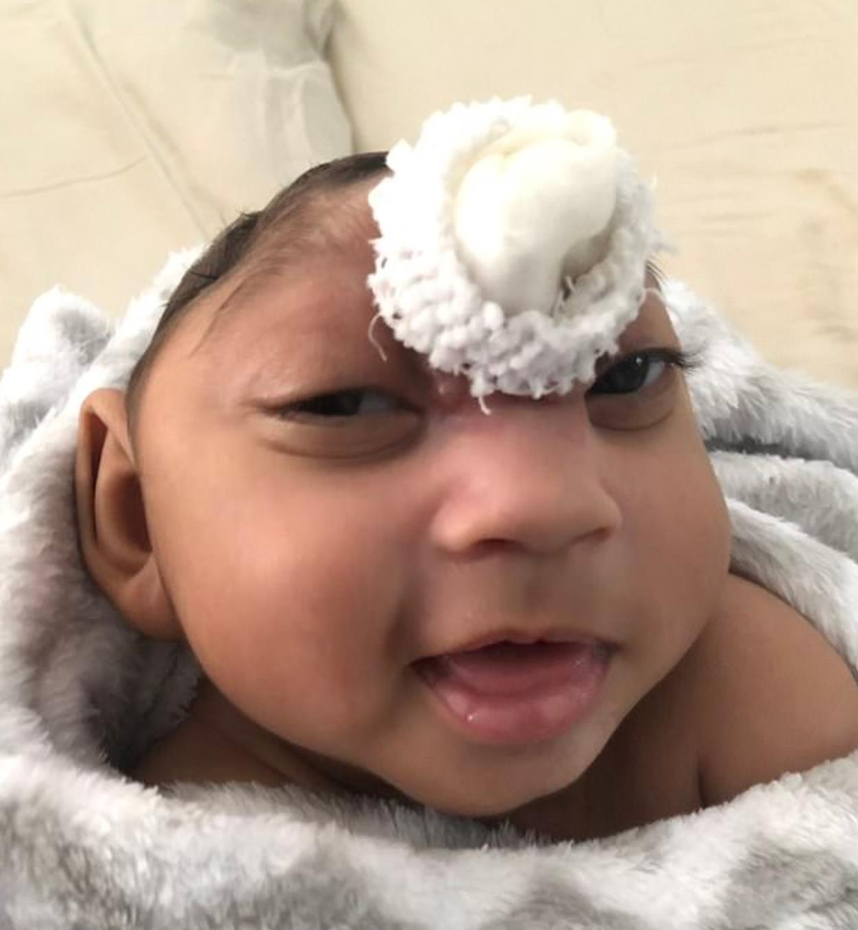 小头畸形的孩子能活多久,孩子出生畸形可以放弃吗