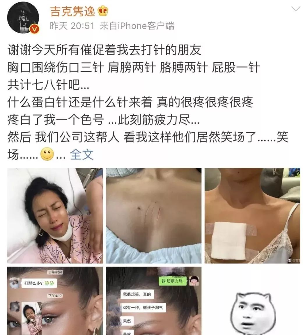 被仓鼠咬伤之后需要打疫苗吗,被仓鼠咬伤抓伤出血要打疫苗吗