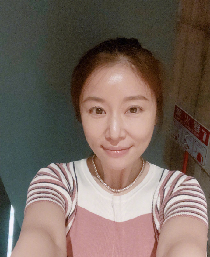 林心如鼻翼两侧法令纹,林心如法令纹现在怎么样了