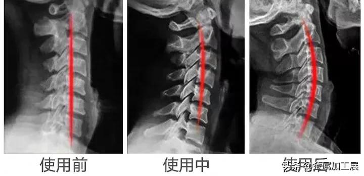 矫正颈椎变形的颈椎枕,日本颈椎专用枕的热敷按摩枕头