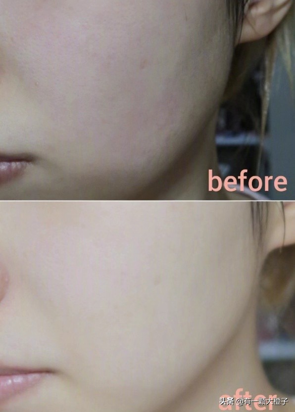 酸奶可以做面膜吗直接涂在脸上,面膜宝藏