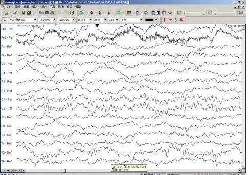南阳医专一附院心内科,南阳医专一附院心血管内科