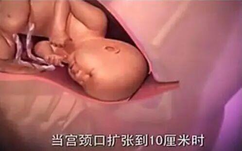 顺产时胎儿是怎么从产道娩出的？组图给你答案，看完觉得*体下**一凉