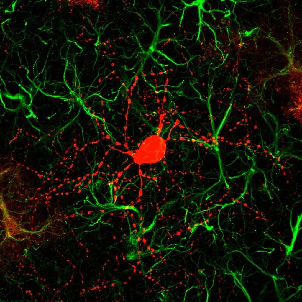 暨南大学陈功团队最新消息,暨南大学陈功教授治疗脑中风研究