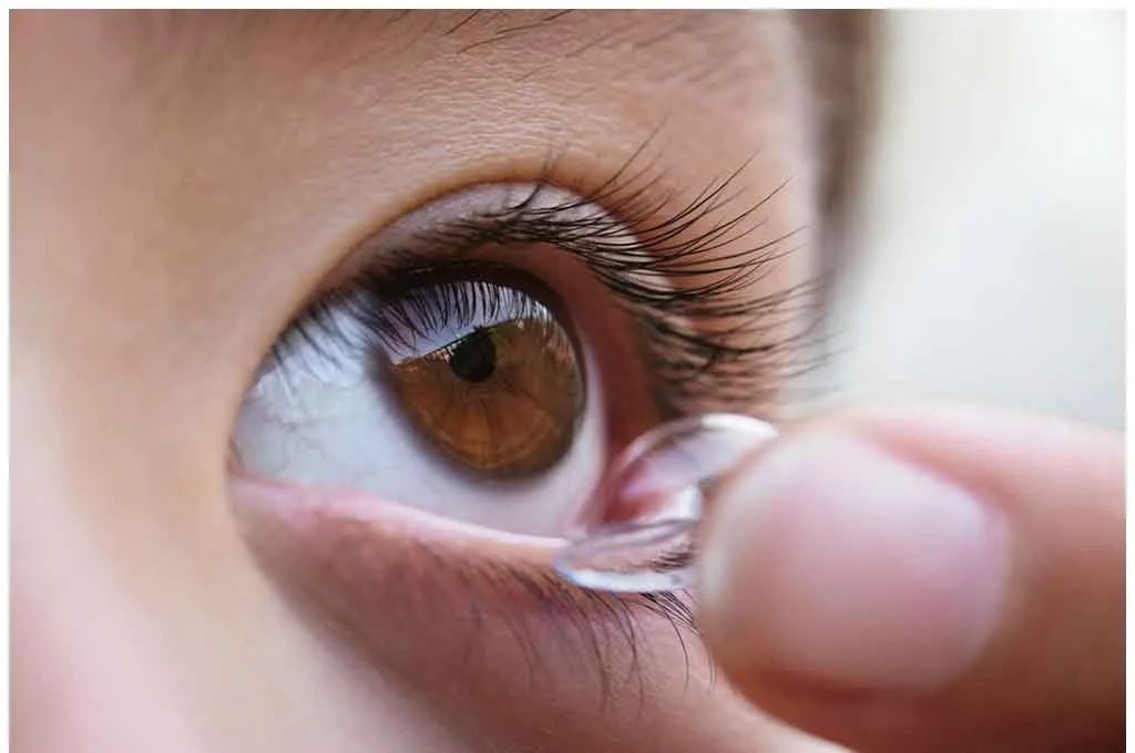 戴隐形眼镜导致角膜损伤,戴隐形眼镜的安全隐患