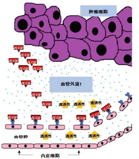 恶性肿瘤胸腔积液严重吗,恶性胸腔积液可以打药吗