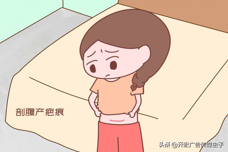 现在剖腹产的疤痕基本是什么样,剖腹产疤痕真的无法去除吗