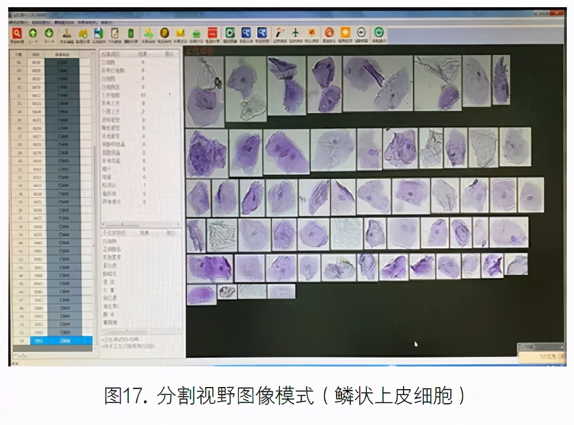 尿液有形成分分析的应用进展,尿液染色方法
