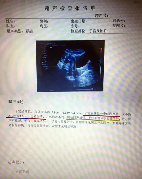 子宫肌瘤的b超报告单,怎样看b超单上的子宫肌瘤