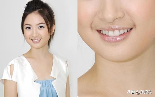 为什么女生嘴唇上面胡子越来越少,女生嘴唇为何长胡子