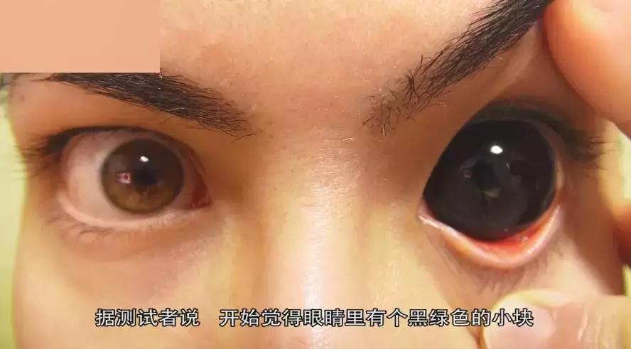 美国黑科技眼药水,美国研制的近视眼药水