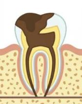 牙通肾，牙不好严重影响性功能！年轻人们长点心吧