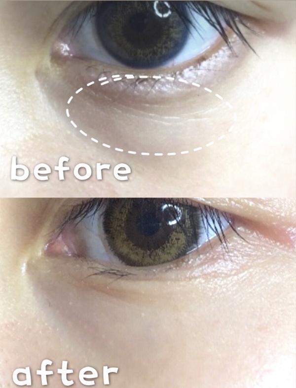 市场里有没有真正能去眼袋的眼霜,药店推荐去眼袋眼霜