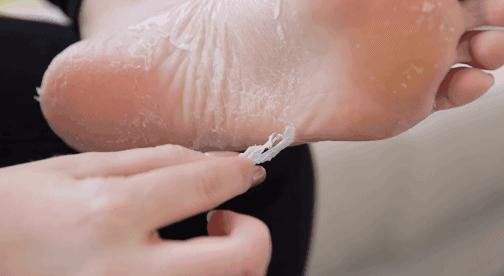 爽炸了！干丑裂的脚皮，一张完整撕掉，敢跟婴儿比姣嫩！