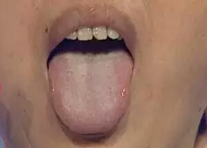 这5个症状需警惕,这十个症状说明你健康