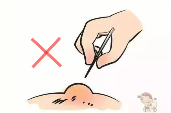 我被开水烫到了怎么办,白开水烫伤怎么处理好得快小孩子