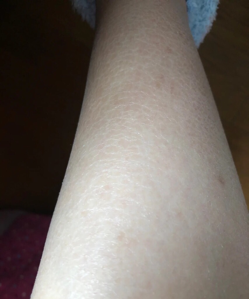 皮肤黑黄干燥用什么身体乳,皮肤比较干燥粗糙适合什么身体乳