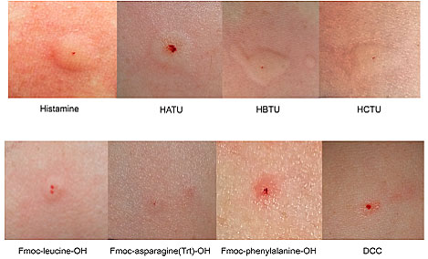 对化学物品过敏怎么办,化学试剂过敏怎么办