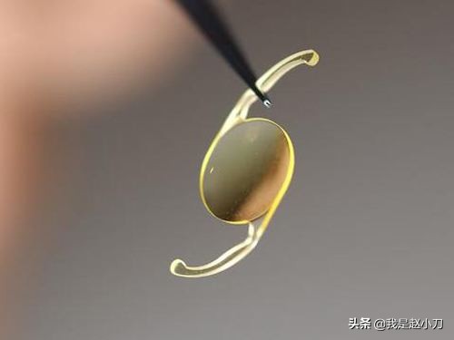 中华医药治疗白内障视频,中国医疗账单