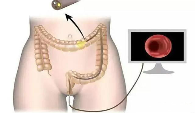 一天拉几次正常的大便是消化好吗,一天拉多次大便怎么样调理肠胃