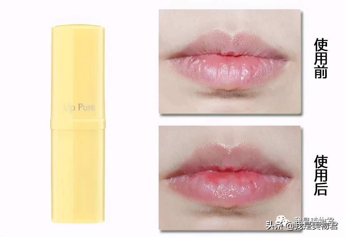 冬季嘴唇防干裂推荐,秋冬嘴皮干裂唇部护理