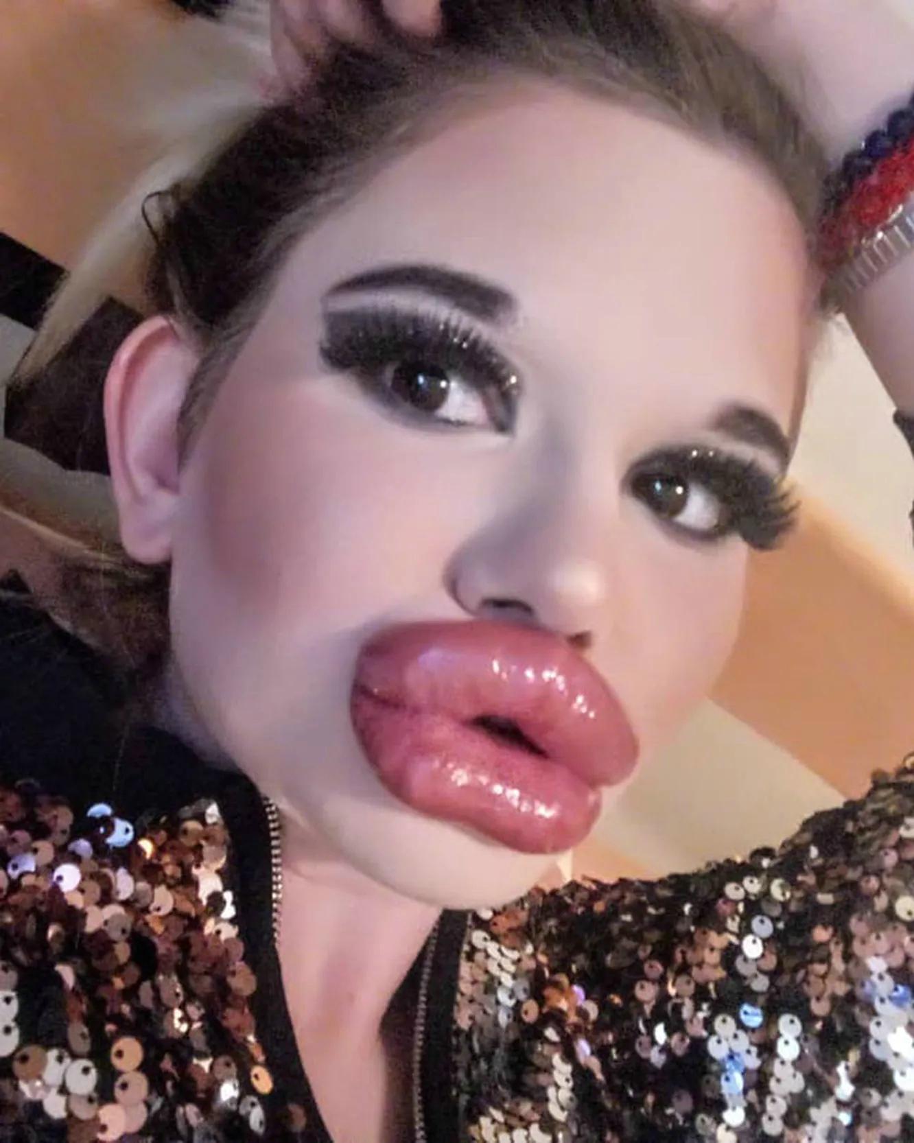 人造女人漂亮吗,人造嘟嘟嘴唇