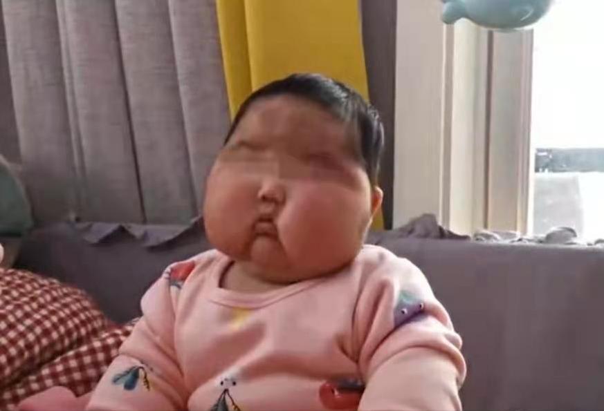 用婴儿面霜额头会长毛吗,婴儿六个月额头上长汗毛