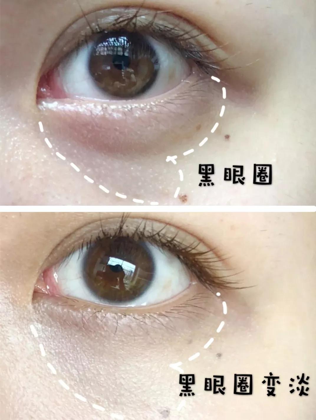 雅诗兰黛日本产的眼霜,用了雅诗兰黛皱纹更明显了