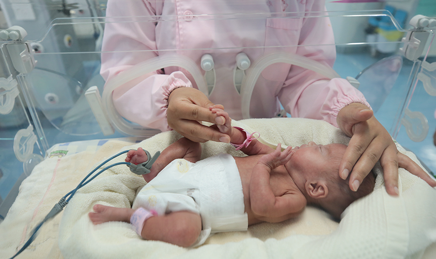 多学科协作成功救治一名危重患者,市二院成功救治30周三胞胎早产儿