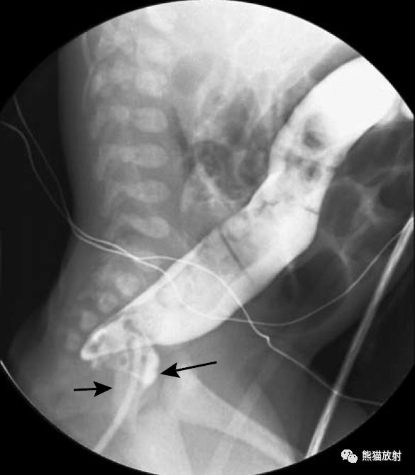 腹部影像图片大全,乙状直肠疼痛位置图片