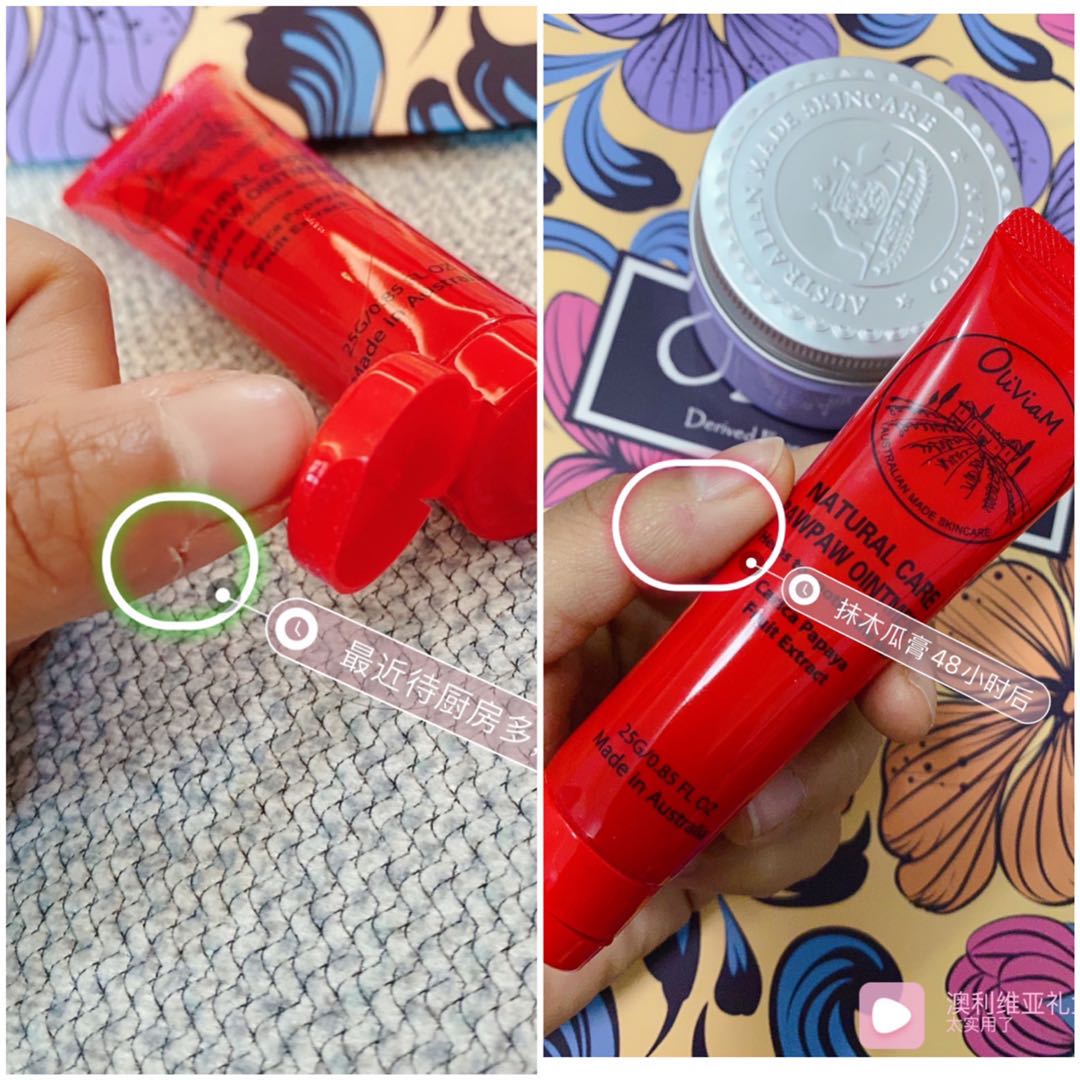 澳洲木瓜膏可以祛痘消炎吗,木瓜膏祛痘疤