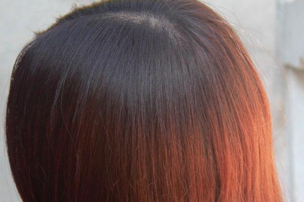 洗头后头皮抠出厚厚的白泥,洗澡的时候头皮能抠出白泥