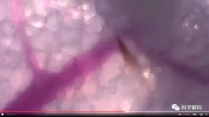 蚊子怎么咬人科普,蚊子解剖示意图