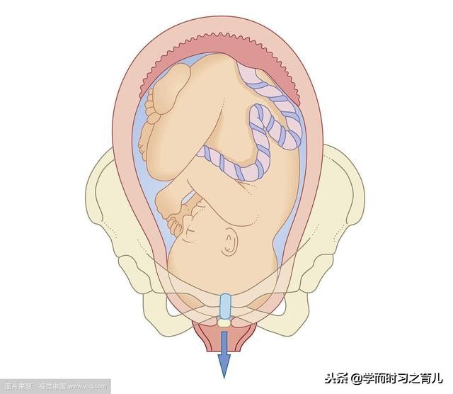 孕妇宝宝踢了妈妈会痛吗,孕妇胎儿踢妈妈肚子